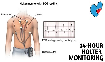 24 Hr Holter in Pune Shivajinagar